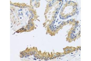 Immunohistochemistry of paraffin-embedded Human prostate using ARL6 Polyclonal Antibody at dilution of 1:100 (40x lens).