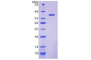 Image no. 1 for Loricrin (LOR) (AA 210-295) protein (His tag,GST tag) (ABIN1981092)