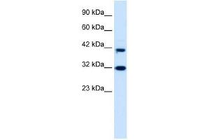 Image no. 1 for anti-D4, Zinc and Double PHD Fingers Family 1 (DPF1) (Middle Region) antibody (ABIN927490)