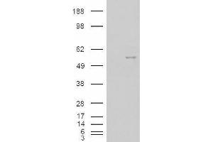 Western Blotting (WB) image for Neuro-Oncological Ventral Antigen 1 (NOVA1) peptide (ABIN369762)