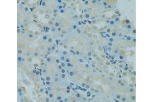PRDM2 antibody
