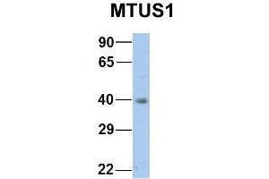 Image no. 7 for anti-Microtubule Associated Tumor Suppressor 1 (MTUS1) (Middle Region) antibody (ABIN2781855)