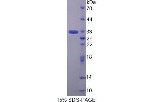Image no. 1 for Torsin Family 1, Member B (Torsin B) (TOR1B) (AA 83-327) protein (His tag) (ABIN6238072)