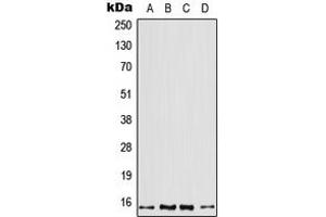 Image no. 1 for anti-Profilin 2 (PFN2) (Center) antibody (ABIN2706872)