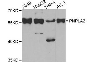 Image no. 1 for anti-Patatin-Like phospholipase Domain Containing 2 (PNPLA2) antibody (ABIN1882372)