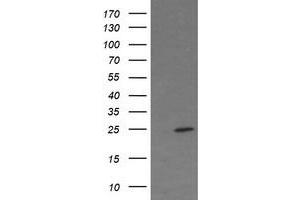 Image no. 3 for anti-Fetal and Adult Testis Expressed 1 (FATE1) antibody (ABIN1498225)