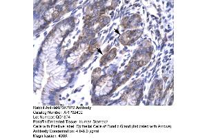 anti-TGF-beta Activated Kinase 1/MAP3K7 Binding Protein 2 (TAB2) (N-Term) antibody
