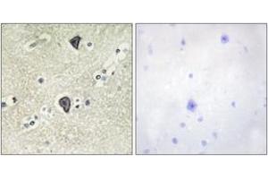 Image no. 2 for anti-Fibroblast Growth Factor Receptor 3 (FGFR3) (AA 131-180) antibody (ABIN1533273)