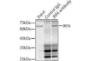 IRF6 anticorps