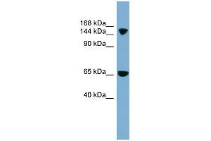 SLC4A5 antibody used at 1 ug/ml to detect target protein.