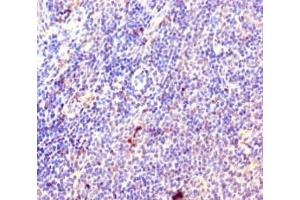 Immunohistochemistry of paraffin-embedded human lymphoid tissue using ABIN7142808 at dilution of 1:100