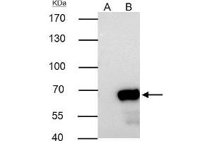NUP62 antibody  (Center)
