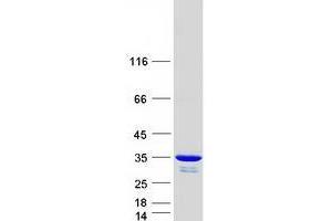 Image no. 1 for Uridine-Cytidine Kinase 2 (UCK2) protein (Myc-DYKDDDDK Tag) (ABIN2734967)