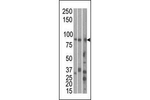Image no. 1 for anti-MAP/microtubule Affinity-Regulating Kinase 1 (MARK1) (AA 671-700), (C-Term) antibody (ABIN391220)