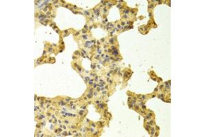 Image no. 1 for anti-TNFRSF1A-Associated Via Death Domain (TRADD) antibody (ABIN3021542)