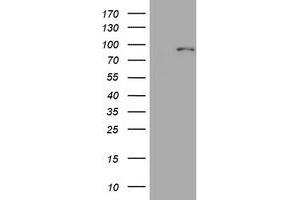 Image no. 1 for anti-Mitofusin 1 (MFN1) (AA 209-469) antibody (ABIN1491184)