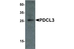 Image no. 2 for anti-Phosducin-Like 3 (PDCL3) (C-Term) antibody (ABIN6657163)
