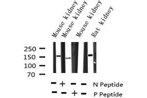 Image no. 1 for anti-VEGF Receptor 2 (VEGFR2) (pTyr951) antibody (ABIN6256071)