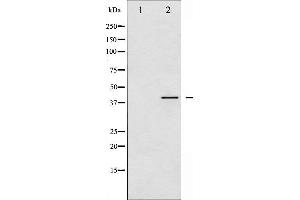 Image no. 1 for anti-Vasodilator-Stimulated phosphoprotein (VASP) (pSer157) antibody (ABIN6256156)