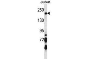 Image no. 1 for anti-BRCA1 Interacting Protein C-terminal Helicase 1 (BRIP1) (AA 135-167), (N-Term) antibody (ABIN950678)