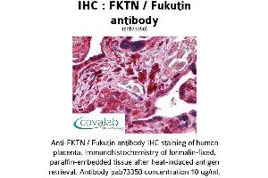 Image no. 2 for anti-Fukutin (FKTN) (AA 272-456) antibody (ABIN1734362)