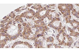 Image no. 1 for anti-Solute Carrier Family 16, Member 9 (Monocarboxylic Acid Transporter 9) (SLC16A9) (Internal Region) antibody (ABIN6263335)