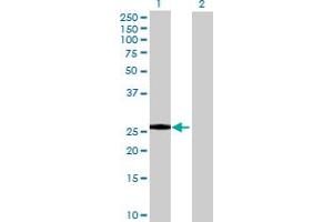 Western Blot analysis of RPAIN expression in transfected 293T cell line by RPAIN MaxPab polyclonal antibody.