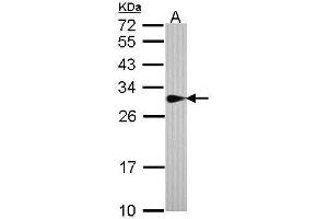 Image no. 4 for anti-Sepiapterin Reductase (SPR) (Center) antibody (ABIN2856918)