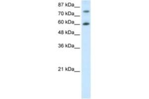 Image no. 1 for anti-Cleavage Stimulation Factor, 3' Pre-RNA, Subunit 3, 77kDa (CSTF3) antibody (ABIN2462105)