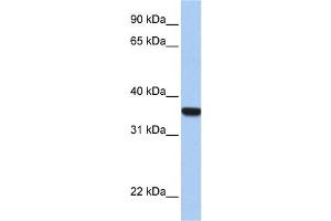 Image no. 1 for anti-Homeobox D1 (HOXD1) (C-Term) antibody (ABIN2779773)
