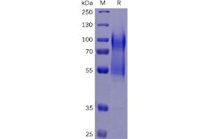 Image no. 1 for CD34 (CD34) protein (His tag) (ABIN6961155)