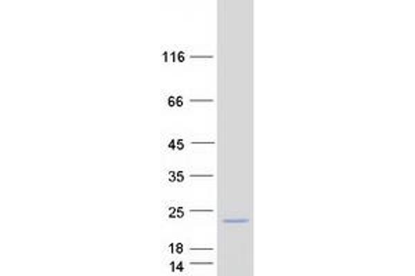 SLC51B Protein (Myc-DYKDDDDK Tag)