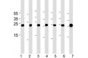Image no. 2 for anti-CCAAT/enhancer Binding Protein (C/EBP), delta (CEBPD) (AA 161-189) antibody (ABIN3030349)