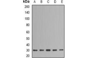 Image no. 3 for anti-Inositol(myo)-1(or 4)-Monophosphatase 1 (IMPA1) antibody (ABIN2966738)