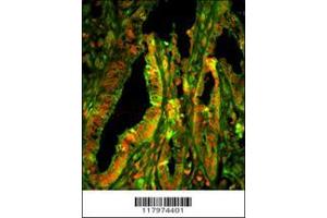 Image no. 2 for anti-Capping Protein (Actin Filament) Muscle Z-Line, alpha 1 (CAPZA1) (AA 1-30), (N-Term) antibody (ABIN391704)