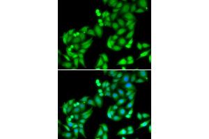 Image no. 2 for anti-COP9 Signalosome Complex Subunit 3 (COPS3) antibody (ABIN6138879)