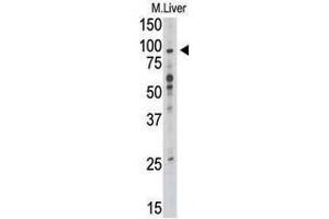 Image no. 1 for anti-Toll-Like Receptor 6 (TLR6) (C-Term) antibody (ABIN357053)