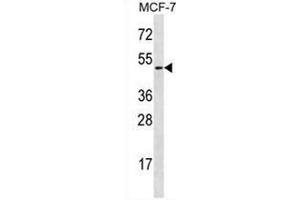 Image no. 2 for anti-Ladinin 1 (LAD1) (AA 150-180), (N-Term) antibody (ABIN953130)