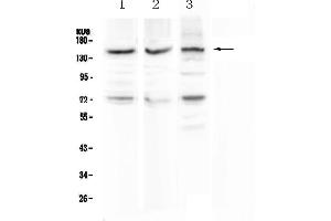 Image no. 1 for anti-CD163 (CD163) (AA 47-201) antibody (ABIN5693082)