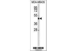 Image no. 3 for anti-Cytochrome P450, Family 21, Subfamily A, Polypeptide 2 (CYP21A2) (AA 216-246) antibody (ABIN652409)