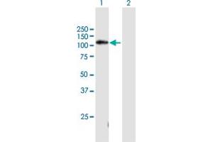 Image no. 1 for anti-Chromosome 11 Open Reading Frame 82 (C11orf82) (AA 1-998) antibody (ABIN531338)