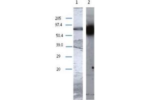Image no. 2 for anti-Transglutaminase 1, Keratinocyte (TGM1) antibody (ABIN1109301)