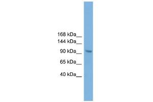Image no. 1 for anti-Zinc Fingers and Homeoboxes 3 (ZHX3) (C-Term) antibody (ABIN2780146)