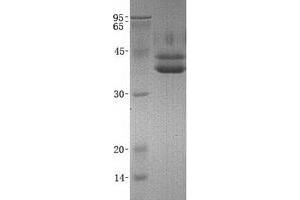 Image no. 1 for Sulfatase Modifying Factor 1 (SUMF1) protein (ABIN2732974)