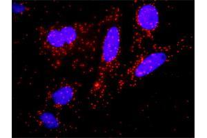 Proximity Ligation Assay (PLA) image for IKBKB & CTNNB1 Protein Protein Interaction Antibody Pair (ABIN1339890)
