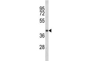 Image no. 3 for anti-Chemokine (C-C Motif) Receptor 3 (CCR3) (AA 291-318) antibody (ABIN3030491)