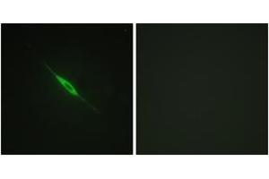Immunofluorescence analysis of NIH-3T3 cells, using PKC delta (Phospho-Tyr52) Antibody.