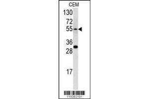 Image no. 2 for anti-Endothelin Receptor Type A (EDNRA) (AA 125-154) antibody (ABIN390401)