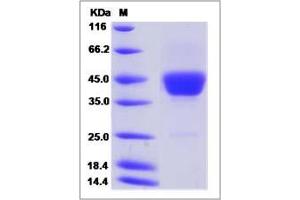 Image no. 1 for CD52 (CD52) (AA 1-46) protein (Fc Tag) (ABIN2008233)