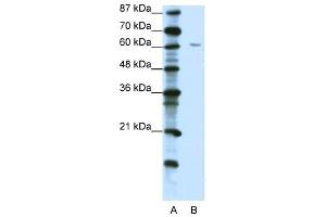 Image no. 1 for anti-Zinc Finger Protein 268A (ZNF286A) (C-Term) antibody (ABIN925920)